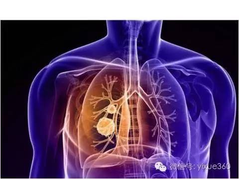 中国治疗肿瘤最新突破，小巷深处的神秘小店揭秘